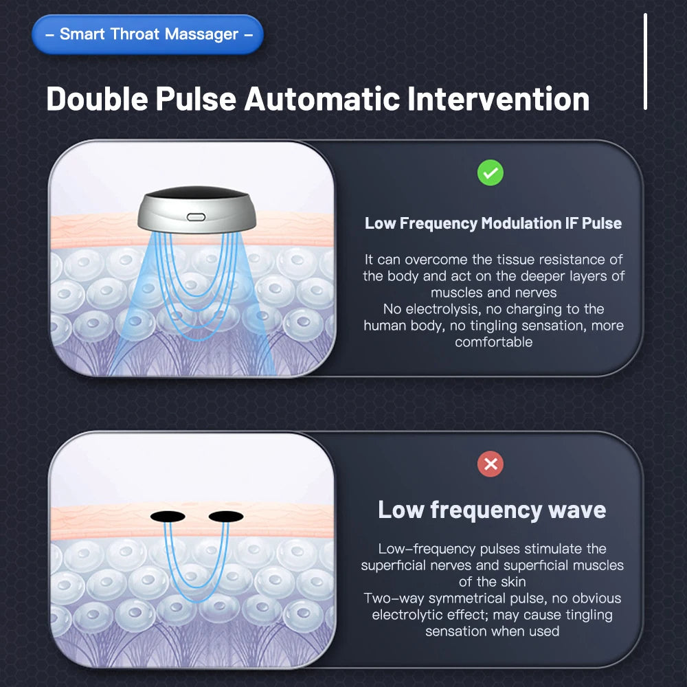 SnoreX Smart Anti-Snoring Blocking Device